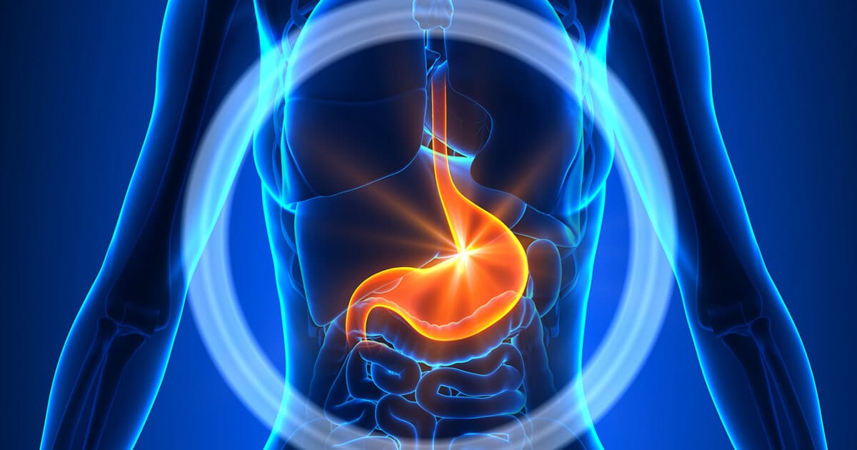 Gastric Sleeve Turkey: Affordable Bariatric Surgery Without Compromising Quality